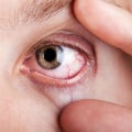 Understanding Common Eye Conditions That Require Specialized Care