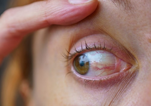 Understanding Eye Care Services: Treatments for Common Eye Conditions