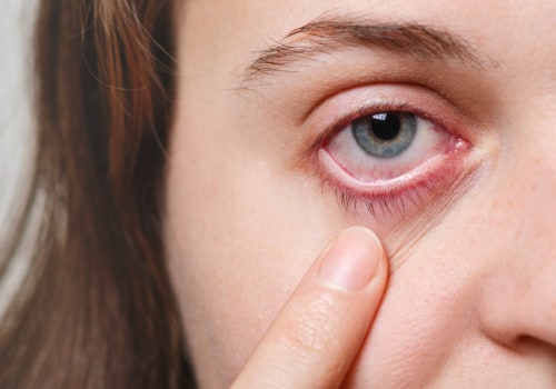 Understanding the Risks of Contact Lens Use and Eye Care Services