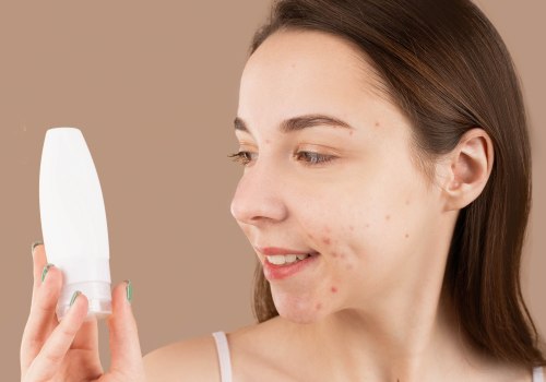 Acne Treatment in Zürich: Enhancing Your Look Beyond Eye Care Services
