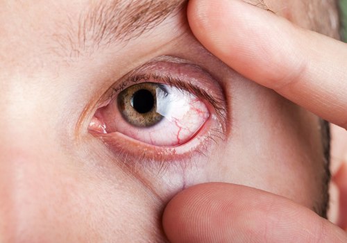 Understanding Common Eye Conditions That Require Specialized Care